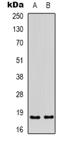 ID4 Antibody - Western blot analysis of ID4 expression in HEK293T (A); HepG2 (B) whole cell lysates.