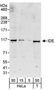 IDE Antibody - Detection of Human IDE by Western Blot. Samples: Whole cell lysate from HeLa (5, 15 and 50 ug) and 293T (T; 50 ug) cells. Antibodies: Affinity purified rabbit anti-IDE antibody used for WB at 0.1 ug/ml. Detection: Chemiluminescence with an exposure time of 3 minutes.