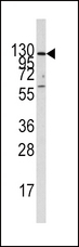 IDE Antibody - Western blot of anti-IDE Antibody in A375 cell line lysates (35 ug/lane). IDE (arrow) was detected using the purified antibody.