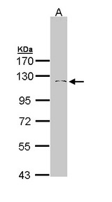 IDE Antibody - Sample (30 ug of whole cell lysate). A: Hep G2. 7.5% SDS PAGE. IDE antibody diluted at 1:1000. 