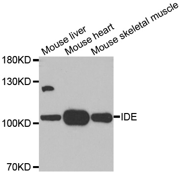 IDE Antibody - Western blot analysis of extracts of various tissues.