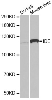 IDE Antibody - Western blot analysis of extracts of various cell lines, using IDE antibody at 1:1000 dilution. The secondary antibody used was an HRP Goat Anti-Rabbit IgG (H+L) at 1:10000 dilution. Lysates were loaded 25ug per lane and 3% nonfat dry milk in TBST was used for blocking. An ECL Kit was used for detection.