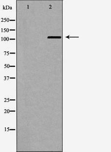 IDE Antibody - Western blot analysis of mouse brain lysate using IDE antibody. The lane on the left is treated with the antigen-specific peptide.