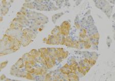 IDE Antibody - 1:100 staining human pancreas tissue by IHC-P. The sample was formaldehyde fixed and a heat mediated antigen retrieval step in citrate buffer was performed. The sample was then blocked and incubated with the antibody for 1.5 hours at 22°C. An HRP conjugated goat anti-rabbit antibody was used as the secondary.