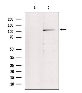 IDE Antibody - Western blot analysis of extracts of 293 cells using IDE antibody. Lane 1 was treated with the blocking peptide.