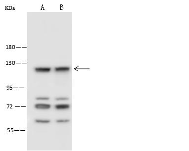IDE Antibody - Anti-IDE rabbit polyclonal antibody at 1:500 dilution. Lane A: HeLa Whole Cell Lysate. Lane B: HepG2 Whole Cell Lysate. Lysates/proteins at 30 ug per lane. Secondary: Goat Anti-Rabbit IgG (H+L)/HRP at 1/10000 dilution. Developed using the ECL technique. Performed under reducing conditions. Predicted band size: 118 kDa. Observed band size: 120 kDa.