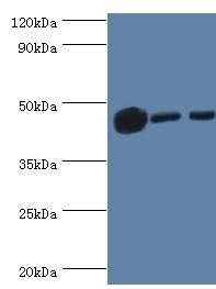 IDH1 / IDH Antibody - Western blot. All lanes: Isocitrate dehydrogenase [NADP] cytoplasmic antibody at 3 ug/ml. Lane 1: mouse liver tissue. Lane 2: HeLa whole cell lysate. Lane 2: NIH3T3 whole cell lysate. secondary Goat polyclonal to rabbit at 1:10000 dilution. Predicted band size: 47 kDa. Observed band size: 47 kDa.