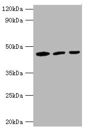 IDH1 / IDH Antibody - Western blot All lanes: IDH1 antibody at 3µg/ml Lane 1: Mouse liver tissue Lane 2: Hela whole cell lysate Lane 3: NIH/3T3 whloe cell lysate Secondary Goat polyclonal to rabbit IgG at 1/10000 dilution Predicted band size: 47 kDa Observed band size: 47 kDa