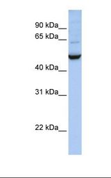 IDH1 / IDH Antibody - 721_B cell lysate. Antibody concentration: 1.0 ug/ml. Gel concentration: 12%.  This image was taken for the unconjugated form of this product. Other forms have not been tested.