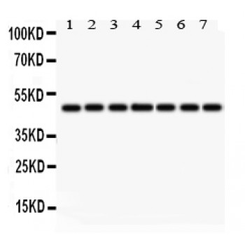 IDH1 / IDH Antibody - IDH1 antibody Western blot. All lanes: Anti IDH1 at 0.5 ug/ml. Lane 1: Rat Lung Tissue Lysate at 50 ug. Lane 2: Rat Kidney Tissue Lysate at 50 ug. Lane 3: Rat Brain Tissue Lysate at 50 ug. Lane 4: HELA Whole Cell Lysate at 40 ug. Lane 5: SMMC Whole Cell Lysate at 40 ug. Lane 6: A549 Whole Cell Lysate at 40 ug. Lane 7: NIH3T3 Whole Cell Lysate at 40 ug. Predicted band size: 47 kD. Observed band size: 47 kD.