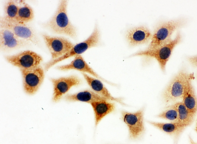 IDH1 / IDH Antibody - IHC analysis of IDH1 using anti-IDH1 antibody. IDH1 was detected in immunocytochemical section of A549 cell. Heat mediated antigen retrieval was performed in citrate buffer (pH6, epitope retrieval solution) for 20 mins. The tissue section was blocked with 10% goat serum. The tissue section was then incubated with 1µg/ml rabbit anti-IDH1 Antibody overnight at 4°C. Biotinylated goat anti-rabbit IgG was used as secondary antibody and incubated for 30 minutes at 37°C. The tissue section was developed using Strepavidin-Biotin-Complex (SABC) with DAB as the chromogen.