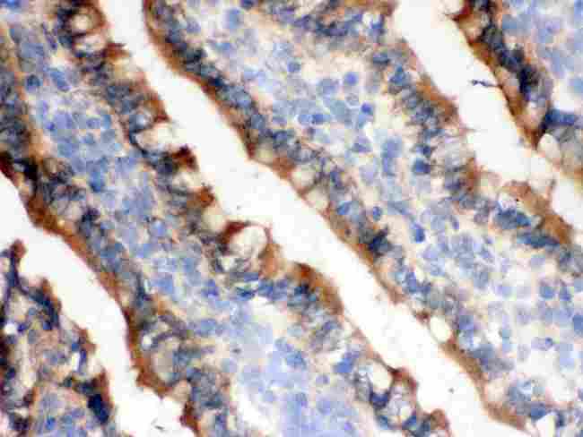 IDH1 / IDH Antibody - IHC analysis of IDH1 using anti-IDH1 antibody. IDH1 was detected in frozen section of rat small intestine tissue. Heat mediated antigen retrieval was performed in citrate buffer (pH6, epitope retrieval solution) for 20 mins. The tissue section was blocked with 10% goat serum. The tissue section was then incubated with 1µg/ml rabbit anti-IDH1 Antibody overnight at 4°C. Biotinylated goat anti-rabbit IgG was used as secondary antibody and incubated for 30 minutes at 37°C. The tissue section was developed using Strepavidin-Biotin-Complex (SABC) with DAB as the chromogen.