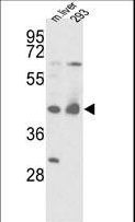IDH1 / IDH Antibody - Western blot of IDH1 Antibody in mouse liver tissue and 293 cell line lysates (35 ug/lane). IDH1 (arrow) was detected using the purified antibody.