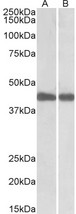 IDH1 / IDH Antibody - Goat Anti-IDH1 (aa65-77) Antibody (0.1µg/ml) staining of Mouse (A) and Rat (B) Liver lysates (35µg protein in RIPA buffer). Primary incubation was 1 hour. Detected by chemiluminescencence.