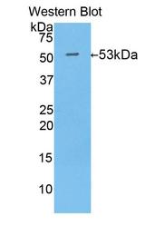 IDH1 / IDH Antibody - Western Blot; Sample: Recombinant protein.
