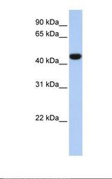IDH1 / IDH Antibody - Fetal liver lysate. Antibody concentration: 1.0 ug/ml. Gel concentration: 12%.  This image was taken for the unconjugated form of this product. Other forms have not been tested.