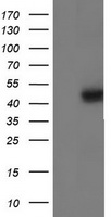 IDH1 / IDH Antibody - HEK293T cells were transfected with the pCMV6-ENTRY control (Left lane) or pCMV6-ENTRY IDH1 (Right lane) cDNA for 48 hrs and lysed. Equivalent amounts of cell lysates (5 ug per lane) were separated by SDS-PAGE and immunoblotted with anti-IDH1.