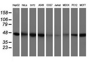IDH1 / IDH Antibody - Western blot of extracts (35ug) from 9 different cell lines by using anti-IDH1 monoclonal antibody (HepG2: human; HeLa: human; SVT2: mouse; A549: human; COS7: monkey; Jurkat: human; MDCK: canine; PC12: rat; MCF7: human).