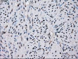 IDH1 / IDH Antibody - Immunohistochemical staining of paraffin-embedded endometrium tissue using anti-IDH1 mouse monoclonal antibody. (Dilution 1:50).