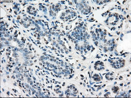 IDH1 / IDH Antibody - Immunohistochemical staining of paraffin-embedded breast tissue using anti-IDH1 mouse monoclonal antibody. (Dilution 1:50).