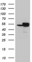 IDH1 / IDH Antibody - HEK293T cells were transfected with the pCMV6-ENTRY control (Left lane) or pCMV6-ENTRY IDH1 (Right lane) cDNA for 48 hrs and lysed. Equivalent amounts of cell lysates (5 ug per lane) were separated by SDS-PAGE and immunoblotted with anti-IDH1.