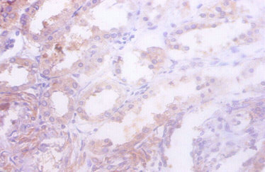 IDH1 / IDH Antibody - Immunohistochemistry of paraffin-embedded human kidney tissue using Idh1 Antibody at dilution of 1:50