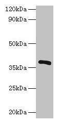 IDH1 / IDH Antibody - Western blot All lanes: Inositol 2-dehydrogenase/D-chiro-inositol 3-dehydrogenase antibody at 2µg/ml + recombinant Inositol 2-dehydrogenase/D-chiro-inositol 3-dehydrogenase protein 0.1µgSecondary Goat polyclonal to rabbit IgG at 1/10000 dilution Predicted band size: 38 kDa Observed band size: 38 kDa