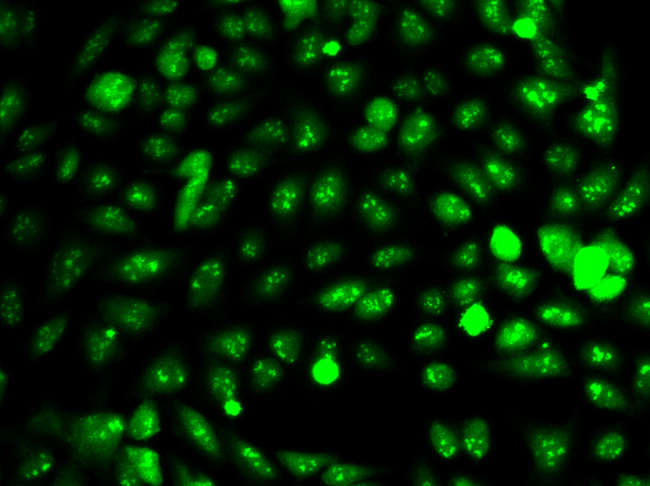 IDH1 / IDH Antibody - Immunofluorescence analysis of HeLa cells.