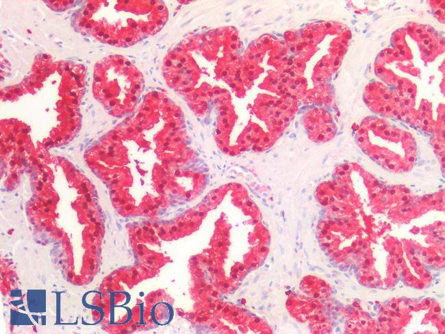 IDH1 / IDH Antibody - Human Prostate: Formalin-Fixed, Paraffin-Embedded (FFPE)