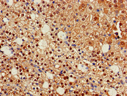 IDH1 / IDH Antibody - Immunohistochemistry of paraffin-embedded human adrenal gland tissue at dilution of 1:100