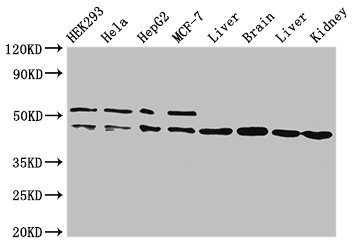 IDH1 / IDH Antibody - Western Blot Positive WB detected in:HEK293 whole cell lysate,Hela whole cell lysate,HepG2 whole cell lysate,MCF-7 whole cell lysate,Rat liver tissue,Mouse brain tissue,Mouse liver tissue,Mouse kidney tissue All Lanes:IDH1 antibody at 2µg/ml Secondary Goat polyclonal to rabbit IgG at 1/50000 dilution Predicted band size: 47 KDa Observed band size: 47,52 KDa