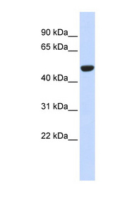 IDH2 Antibody - IDH2 antibody Western blot of Fetal Muscle lysate. This image was taken for the unconjugated form of this product. Other forms have not been tested.