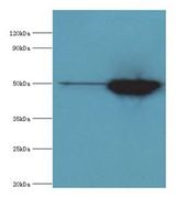IDH2 Antibody - Western blot. All lanes: IDH2 antibody at 5 ug/ml. Lane 1: HeLa whole cell lysate. Lane 2: mouse heart tissue. Secondary antibody: Goat polyclonal to rabbit at 1:10000 dilution. Predicted band size: 50 kDa. Observed band size: 50 kDa.