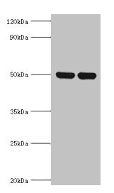 IDH2 Antibody - Western blot All lanes: IDH2 antibody at 5µg/ml Lane 1: Hela whole cell lysate Lane 2: Mouse heart tissue Secondary Goat polyclonal to rabbit IgG at 1/10000 dilution Predicted band size: 51, 46 kDa Observed band size: 51 kDa