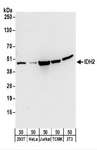 IDH2 Antibody - Detection of Human and Mouse IDH2 by Western Blot. Samples: Whole cell lysate (50 ug) from 293T, HeLa, Jurkat, mouse TCMK-1, and mouse NIH3T3 cells. Antibodies: Affinity purified rabbit anti-IDH2 antibody used for WB at 0.4 ug/ml. Detection: Chemiluminescence with an exposure time of 30 seconds.