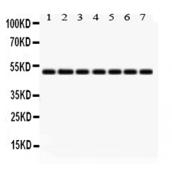 IDH2 Antibody - IDH2 antibody Western blot. All lanes: Anti IDH2 at 0.5 ug/ml. Lane 1: Rat Cardiac Muscle Tissue Lysate at 50 ug. Lane 2: Rat Liver Tissue Lysate at 50 ug. Lane 3: NIH3T3 Whole Cell Lysate at 40 ug. Lane 4: SW620 Whole Cell Lysate at 40 ug. Lane 5: HELA Whole Cell Lysate at 40 ug. Lane 6: MCF-7 Whole Cell Lysate at 40 ug. Lane 7: 22RV1 Whole Cell Lysate at 40 ug. Predicted band size: 51 kD. Observed band size: 51 kD.