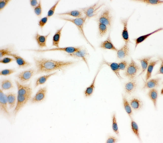 IDH2 Antibody - IHC analysis of IDH2 using anti-IDH2 antibody. IDH2 was detected in immunocytochemical section of A549 cell. Heat mediated antigen retrieval was performed in citrate buffer (pH6, epitope retrieval solution) for 20 mins. The tissue section was blocked with 10% goat serum. The tissue section was then incubated with 1µg/ml rabbit anti-IDH2 Antibody overnight at 4°C. Biotinylated goat anti-rabbit IgG was used as secondary antibody and incubated for 30 minutes at 37°C. The tissue section was developed using Strepavidin-Biotin-Complex (SABC) with DAB as the chromogen.