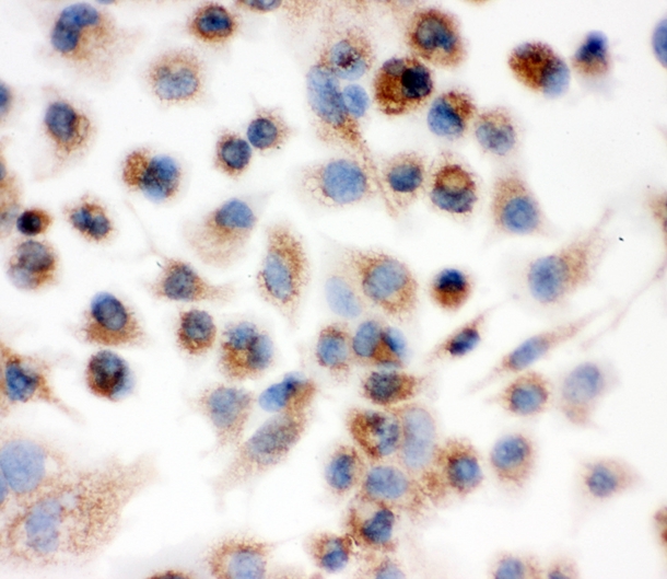 IDH2 Antibody - IHC analysis of IDH2 using anti-IDH2 antibody. IDH2 was detected in immunocytochemical section of Hep1-6 cell. Heat mediated antigen retrieval was performed in citrate buffer (pH6, epitope retrieval solution) for 20 mins. The tissue section was blocked with 10% goat serum. The tissue section was then incubated with 1µg/ml rabbit anti-IDH2 Antibody overnight at 4°C. Biotinylated goat anti-rabbit IgG was used as secondary antibody and incubated for 30 minutes at 37°C. The tissue section was developed using Strepavidin-Biotin-Complex (SABC) with DAB as the chromogen.