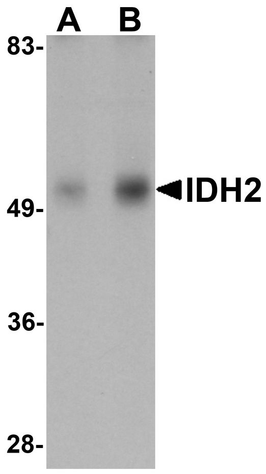 IDH2 Antibody - Western blot analysis of IDH2 in human heart tissue lysate with IDH2 antibody at (A) 1 and (B) 2 ug/ml.