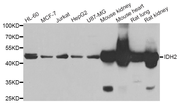 IDH2 Antibody - Western blot analysis of extracts of various cell lines.