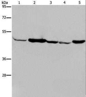 IDH2 Antibody - Western blot analysis of Human fetal muscle tissue, Jurkat and 293T cell, HeLa cell and mouse liver tissue, using IDH2 Polyclonal Antibody at dilution of 1:600.