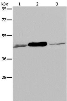 IDH2 Antibody - Western blot analysis of 293T and Jurkat cell, human fetal muscle tissue, using IDH2 Polyclonal Antibody at dilution of 1:600.