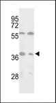 IDH3A Antibody - Western blot of Isocitrate dehydrogenase in MCF-7, Jurkat cell line lysates (35 ug/lane). Isocitrate dehydrogenase (arrow) was detected using the purified antibody.
