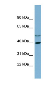 IDH3A Antibody - IDH3A antibody Western blot of COLO205 cell lysate. This image was taken for the unconjugated form of this product. Other forms have not been tested.