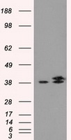 IDH3A Antibody - HEK293T cells were transfected with the pCMV6-ENTRY control (Left lane) or pCMV6-ENTRY IDH3A (Right lane) cDNA for 48 hrs and lysed. Equivalent amounts of cell lysates (5 ug per lane) were separated by SDS-PAGE and immunoblotted with anti-IDH3A.
