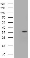 IDH3A Antibody - HEK293T cells were transfected with the pCMV6-ENTRY control (Left lane) or pCMV6-ENTRY IDH3A (Right lane) cDNA for 48 hrs and lysed. Equivalent amounts of cell lysates (5 ug per lane) were separated by SDS-PAGE and immunoblotted with anti-IDH3A.