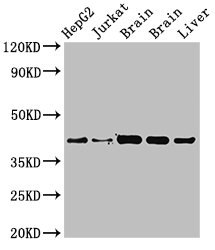 IDH3A Antibody - Positive Western Blot detected in HepG2 whole cell lysat, Jurkat whole cell lysate, Rat brain tissue, Mouse brain tissue, Mouse liver tissue. All lanes: IDH3A antibody at 3.4 µg/ml Secondary Goat polyclonal to rabbit IgG at 1/50000 dilution. Predicted band size: 40, 32 KDa. Observed band size: 40 KDa