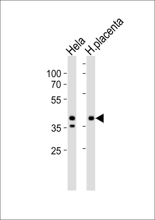 IDH3B Antibody - Western blot of lysates from HeLa cell line and human placenta tissue lysate (from left to right) with IDH3B Antibody. Antibody was diluted at 1:1000 at each lane. A goat anti-rabbit IgG H&L (HRP) at 1:5000 dilution was used as the secondary antibody. Lysates at 35 ug per lane.