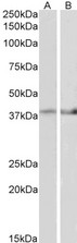 IDH3B Antibody - Goat Anti-IDH3B (aa33-46) Antibody (2µg/ml) staining of Mouse Heart (A) and Mouse Muscle (B) lysate (35µg protein in RIPA buffer). Primary incubation was 1 hour. Detected by chemiluminescencence.