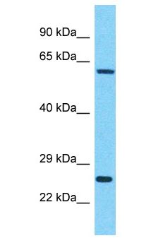 IDH3B Antibody - IDH3B antibody Western Blot of HepG2. Antibody dilution: 1 ug/ml.  This image was taken for the unconjugated form of this product. Other forms have not been tested.